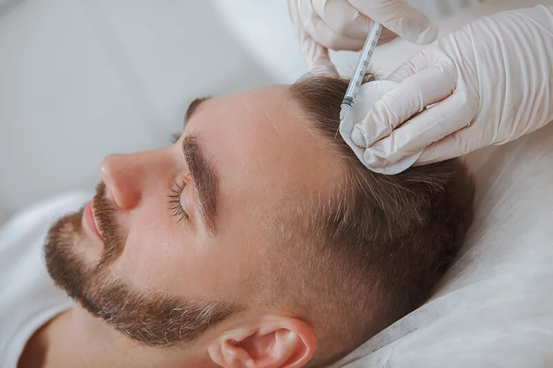 Wie funktioniert PRP für die Haarwiederherstellung?